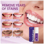 Hi Smile Teeth Serum